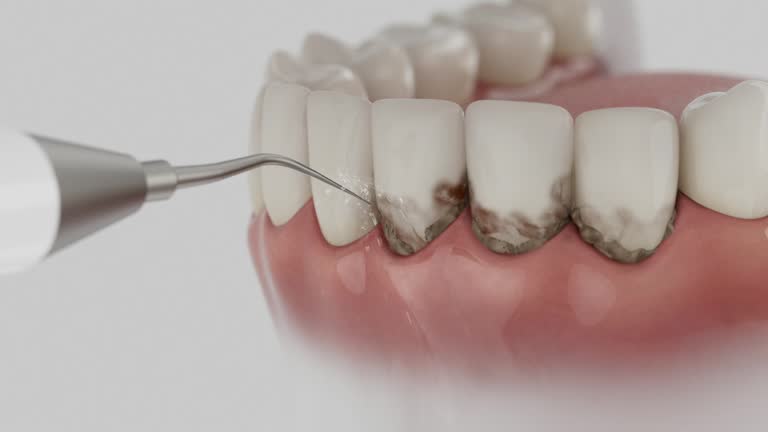 Reliable Dental Implants contractor in Lorenzo, TX by Smile Center Dentistry